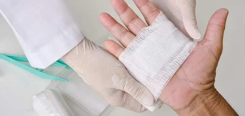 Doctor doing wound dressing care and bandaging patient's hand, Hand surgery treatment